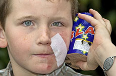 8-year-old Joseph Mains with the firework that injured his face. Photo / Kenny Rodger 8-year-old Joseph Mains with the firework that injured his face. Photo / Kenny Rodger
