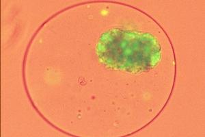 Pig cells specially coated in a seaweed-based gel release insulin and other essential hormones. Photo / Supplied