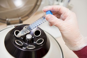After three decades which have seen the progressive refinement of hi-tech methods to help people reproduce, the biggest revolution in IVF - slashing the cost of treatment and making it available to all - is still to come. Photo / Thinkstock