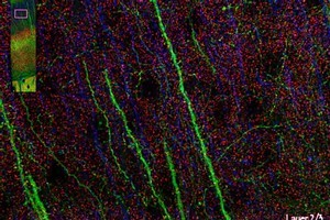 Visual reconstruction (from array-tomography data) of synapses in the mouse somatosensory cortex. Photo / Supplied