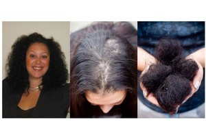 Kirstine Morris suffered major hair loss after a straightening treatment in a hair salon. Photos / Supplied, Greg Bowker