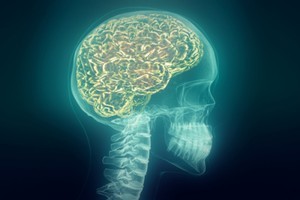 Photo / Thinkstock