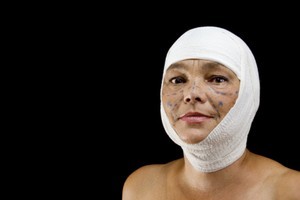 Middle-income earners are heading overseas to get nose jobs and tidy-ups. Photo / Thinkstock