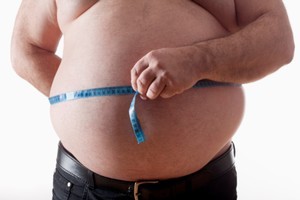 New Zealand's obesity rate increased surged ahead over the past decade, according to a new report. File photo / Thinkstock