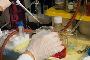 Up to 6,800 people may have been exposed to HIV and hepatitis an Ottawa clinic over the past decade, health officials in Canada have warned. Photo / Thinkstock