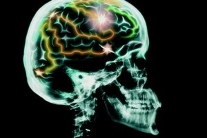 Psychologist Daniel Kahneman lays out how we can avoid the cognitive traps that lead us astray. Photo / Thinkstock