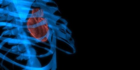A new wireless pacemaker uses acoustic waves to a receiver the size of a grain of rice. Photo / Thinkstock A new wireless pacemaker uses acoustic waves to a receiver the size of a grain of rice. Photo / Thinkstock