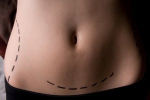 Cosmetic surgery has made the quest to achieve cultural beauty ideals all the more accessible.
Photo / Thinkstock