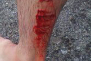 Peter Garrett was bitten in the calf by a shark while surfing near Opunake. Photo / Supplied