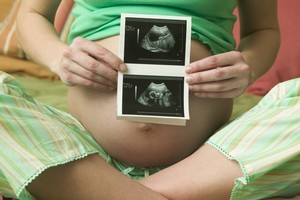 Abortions can be performed up to birth provided two doctors agree that it is necessary. Photo / Thinkstock