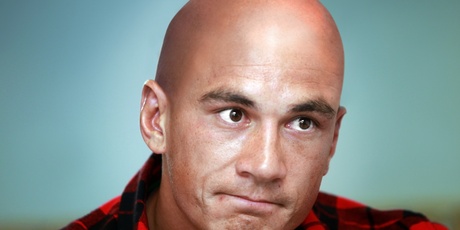 A follicly challenged Sonny Bill Williams would still be pleasing on the eye. Digitally altered image. Photo / Doug Sherring