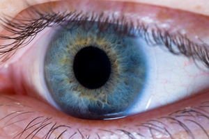 Auckland scientists have made important discoveries that may help battle eye diseases. Photo / Thinkstock