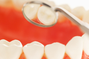 Acidic food and drinks contribute to dental problems for Kiwis.
Photo / Thinkstock