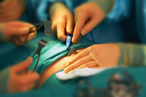 ACC has been forced to provide cover for women who have a baby as a result of a failed sterilisation operation. Photo / Thinkstock
