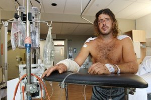 Struck by a car, David Eagle, smashed his head into the windscreen and broke multiple bones in his body and busted his face.