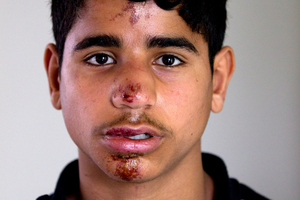 Abbas Alethary, 13, came to bleeding and dazed and was taken to hospital. Photo / Steven McNicholl