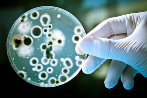 A potentially fatal bacterial disease is affecting people in Australia's Northern Territory. Photo / Thinkstock
