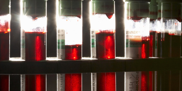 Instead of drawing blood samples and waiting for test results, scientists in Israel have developed a device which uses light on skin to show high-resolution images of blood cells allowing instant diagnosis. Photo / Thinkstock