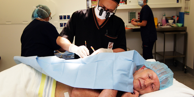 The tables turn on surgeon Martin Rees as three moles are removed from his back and stomach. Photo / Doug Sherring
