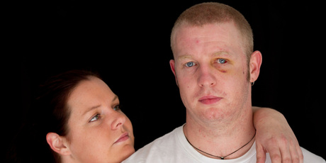 Mathew White, who was hit in the head with a road cone, and partner Pascale Hopkins. Doctors say they will cut open his face in three places today. Photo / Richard Robinson.