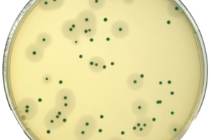 A petri dish containing Listeria Photo / Supplied