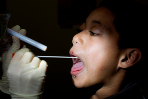 Paul Toala, from Rongomai School in East Tamaki, was found to have red and inflamed tonsils when a nurse took a swab from his throat. Photo / Sarah Ivey