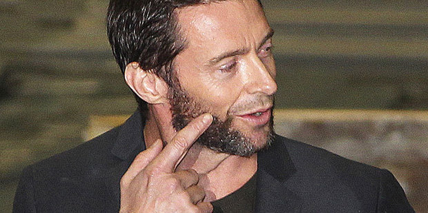 Hugh Jackman shows off his injured right eye during a press conference for his latest movie The Wolverine in Sydney. Photo / AP