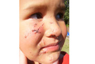 Tane Saneva, now 4, needed surgery to repair facial injuries after he was attacked by a dog at his father's property last year. Photo / Supplied Tane Saneva, now 4, needed surgery to repair facial injuries after he was attacked by a dog at his father's property last year. Photo / Supplied
