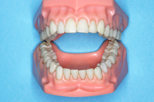 Photo / Thinkstock