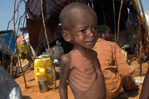 Western greed is partly to blame for children starving in places such as Somalia. Photo / AP
