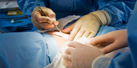 Four women who had their breasts removed - only to be told later there had been a mix-up with specimens. Photo / Thinkstock