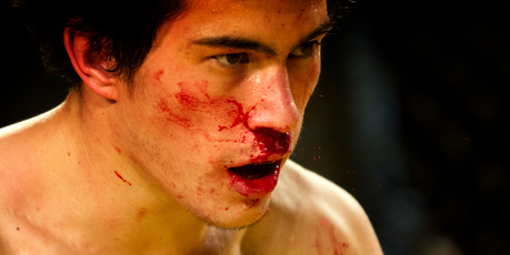 Joesph Spiers' cuts are typical of about half the injuries in MMA. Photo / Brett Phibbs