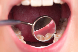 Open wide and say 'there's no government money to fund dental school expansion'. Photo / Thinkstock