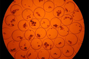 Viewed under a microscope, choroid plexus cells from pigs are almost identical to human cells, which is why the therapy may be successful. Photo / Supplied