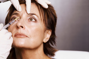 Botox is a touchy topic.Photo / Thinkstock
