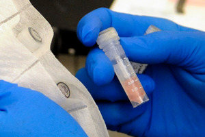 Laboratory technician Ruth Rutledge packages cerebrospinal fluid of three confirmed meningitis cases in Minnesota, to send to the Centers for Disease Control. Photo / AP
