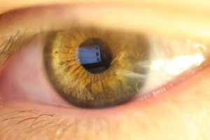 In iridology, the iris is studied for indications of bodily health and disease. Photo / Wikimedia Commons image posted by user Mobentec