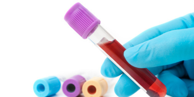 The research represents the first time the ageing test has been used successfully on animals living outside a laboratory. Photo / Thinkstock