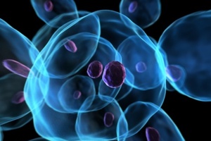 A new test can diagnose colorectal cancer with an accuracy of more than 75 per cent.Photo / Thinkstock