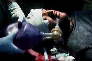 A Pakistani injured polio worker is treated at a local hospital in Peshawar, Pakistan. Photo / AP