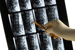 File photo / Thinkstock