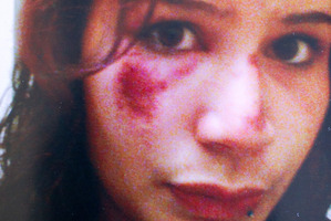 Danielle King showing the marks on her face after an incident in Hamilton. Photo / Supplied