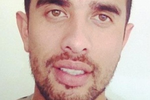 David Playle could hear the bones cracking as his boyfriend was attacked by a group of men early on Sunday morning. Photo / supplied
