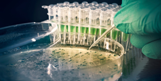 Researchers have genetically modified one of the most common bacteria on earth to create a synthetic biofuel. Photo / Thinkstock