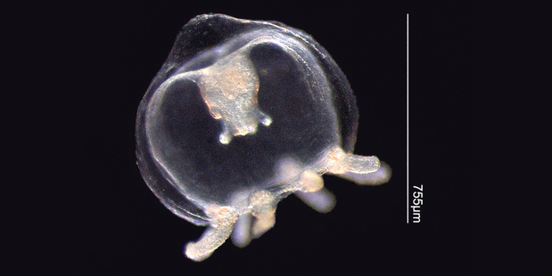 The microscopic jellyfish - or hydromedusae - are invisible in the water and can cause painful rashes.