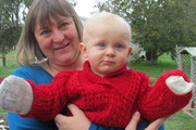 Little battler: Toddler's hands burnt by fire