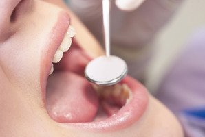 A special tribunal yesterday voted 7 to 1 in favour of removing fluoride from the city's water supply following four days of submissions. Photo / Thinkstock