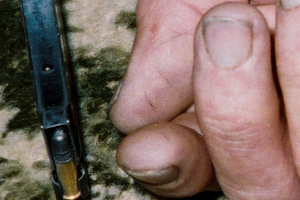 The marks on Robin Bain's thumb can be seen on this photographic evidence.