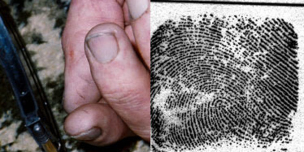 The marks on Robin Bain's thumb can be seen in photographic evidence, while there is an absence of fingerprint markings on the sample taken by police (right), which matches the marks.