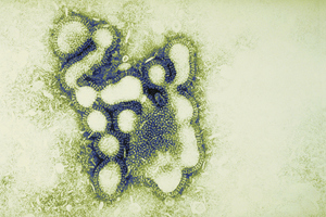 Influenza Virus at 295,000 Magnification. Photo / Getty Images